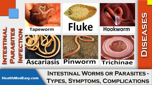 Human Worm Parasite Identification Chart